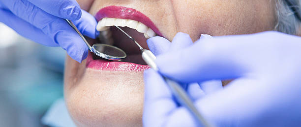 Best Emergency Tooth Extraction in Coopertown, TN